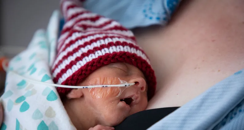 Un bébé prématuré, coiffé d’un bonnet rayé rouge et blanc, repose sa tête sur la poitrine d’une personne. Une sonde d’alimentation est fixée à son visage avec du ruban adhésif. Le bébé est emmitouflé dans une couverture bleue ornée de cœurs.
