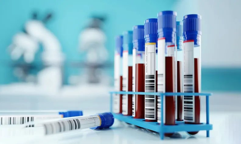 A close-up view of multiple blood-filled test tubes standing upright in a blue plastic rack on a laboratory counter. Each test tube has a blue cap and a white label with barcodes. One test tube lies on its side in the foreground. 