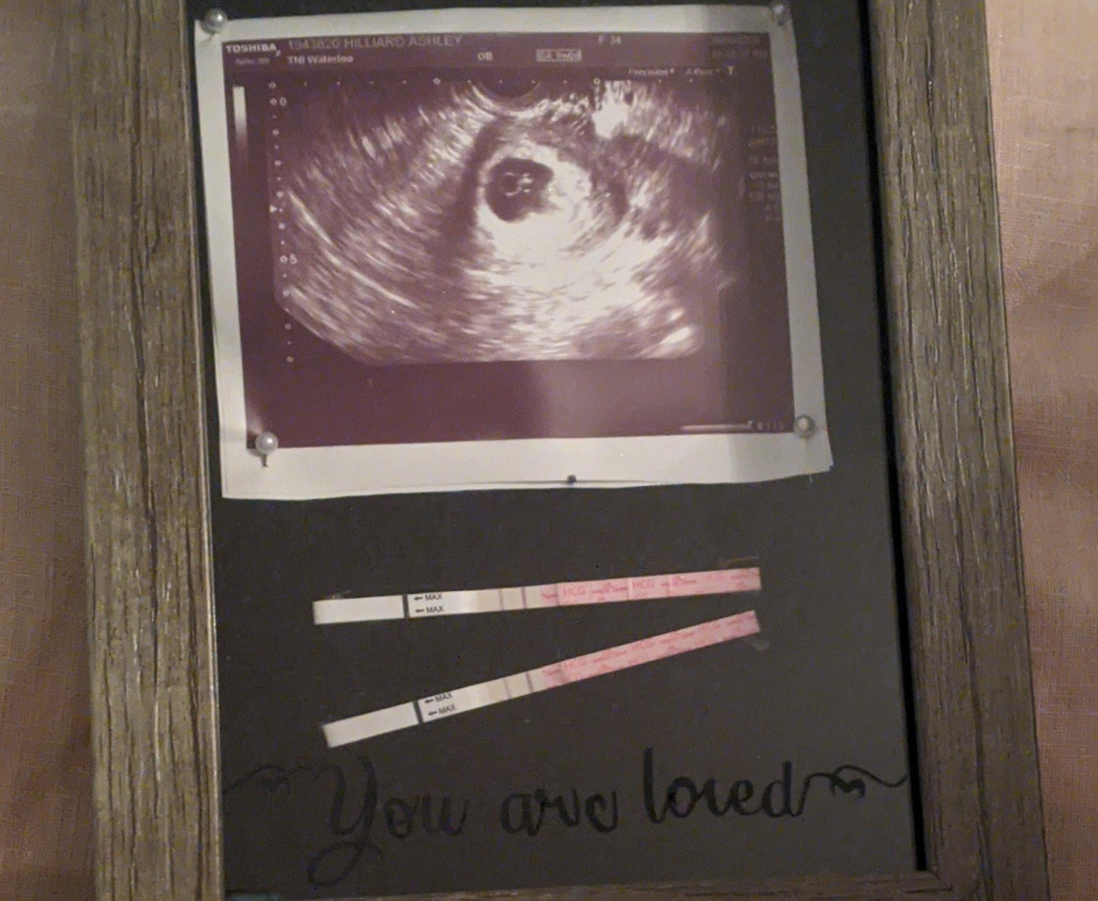 Ashley And Her Husband Mike Experienced A Miscarriage Weeks After An Early Ultrasound